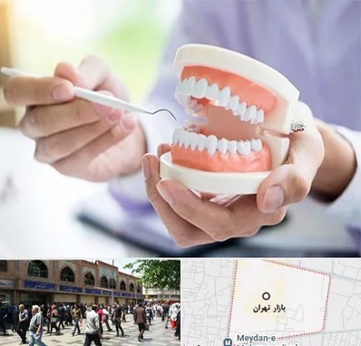 دندانسازی در بازار تهران