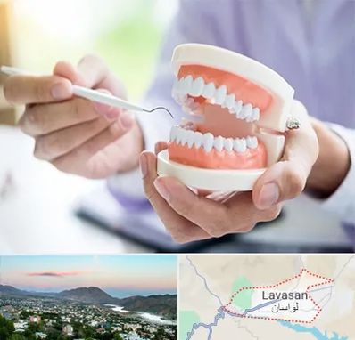 دندانسازی در لواسان