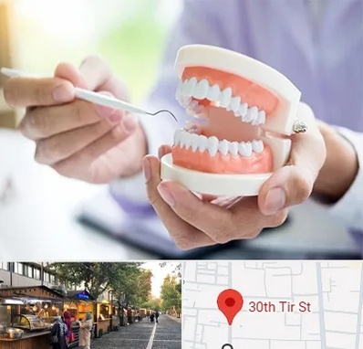 دندانسازی در سی تیر