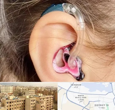 ساخت قالب سمعک در جنوب غرب تهران