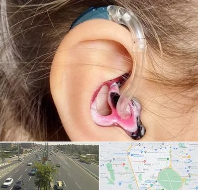 ساخت قالب سمعک در منطقه 17 تهران 