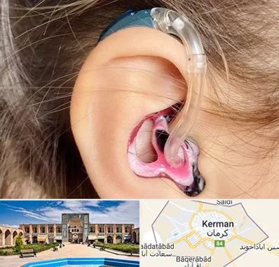ساخت قالب سمعک در کرمان