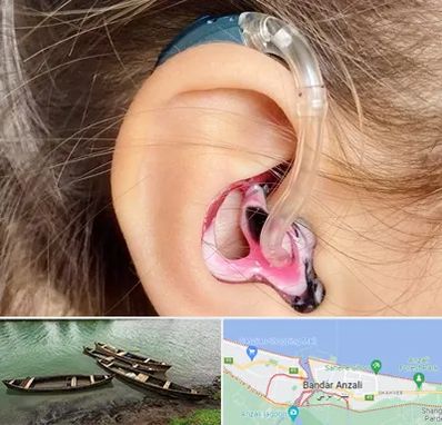 ساخت قالب سمعک در بندر انزلی