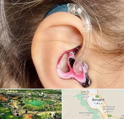 ساخت قالب سمعک در بروجرد