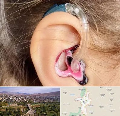 ساخت قالب سمعک در بوکان