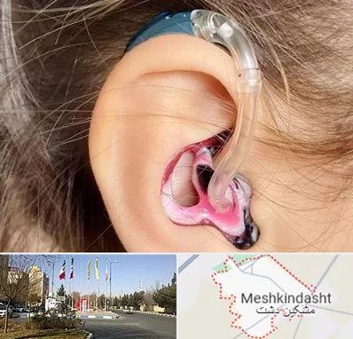 ساخت قالب سمعک در مشکین دشت