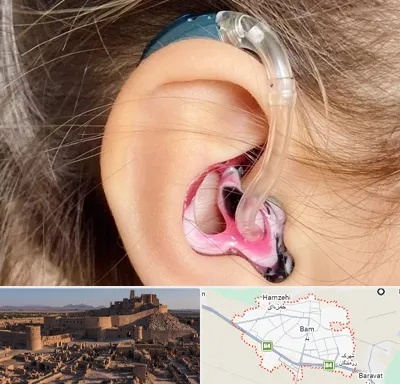 ساخت قالب سمعک در بم
