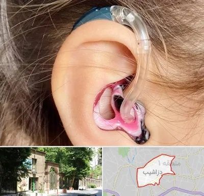ساخت قالب سمعک در دزاشیب
