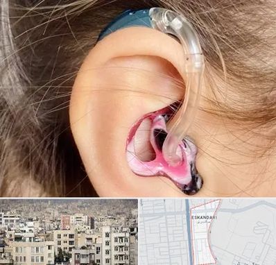 ساخت قالب سمعک در اسکندری