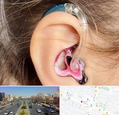 ساخت قالب سمعک در بلوار معلم مشهد 