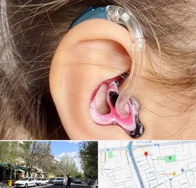 ساخت قالب سمعک در کوی فیروز تبریز