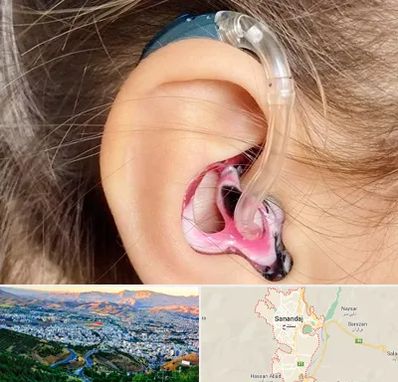 ساخت قالب سمعک در سنندج