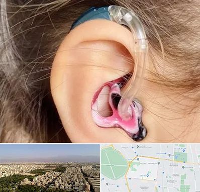 ساخت قالب سمعک در نازی آباد 