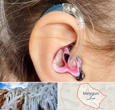 ساخت قالب سمعک در میگون