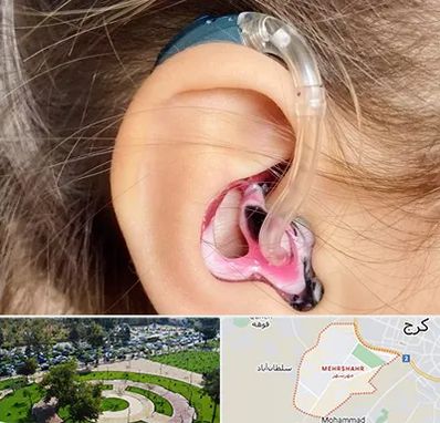 ساخت قالب سمعک در مهرشهر کرج 