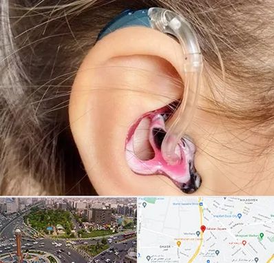 ساخت قالب سمعک در سبلان 