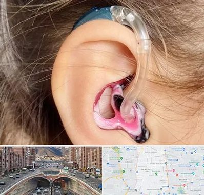 ساخت قالب سمعک در منطقه 10 تهران 