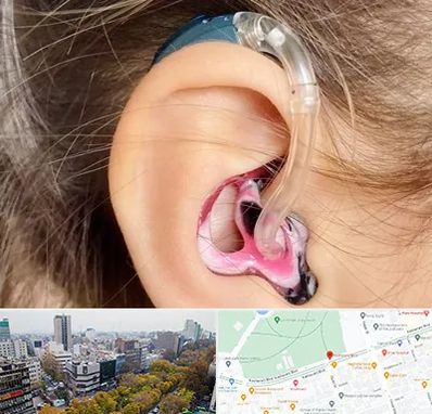 ساخت قالب سمعک در بلوار کشاورز 