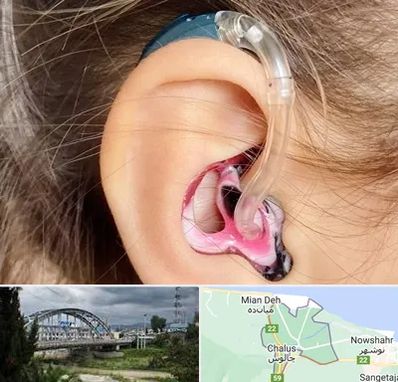 ساخت قالب سمعک در چالوس