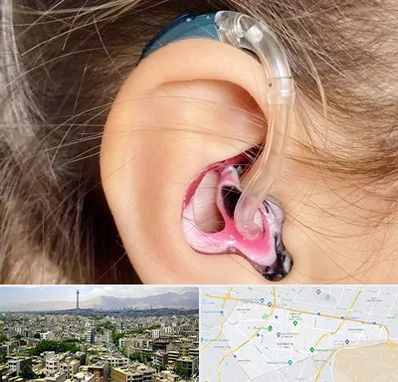 ساخت قالب سمعک در منطقه 8 تهران 