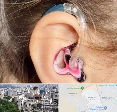 ساخت قالب سمعک در ولنجک 