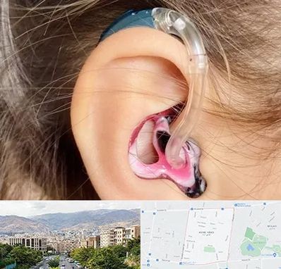 ساخت قالب سمعک در خانی آباد 