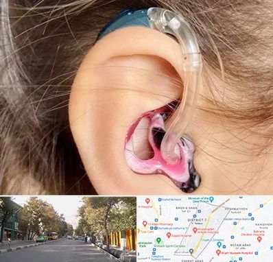 ساخت قالب سمعک در شریعتی 