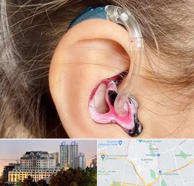 ساخت قالب سمعک در فرشته 