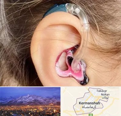 ساخت قالب سمعک در کرمانشاه