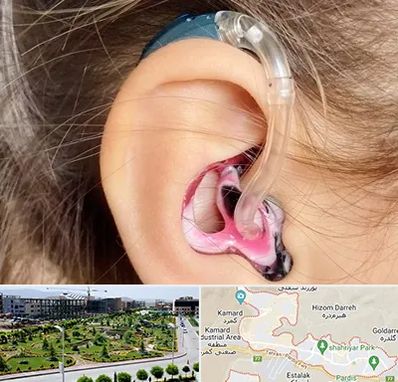 ساخت قالب سمعک در پردیس