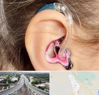 ساخت قالب سمعک در اندیمشک