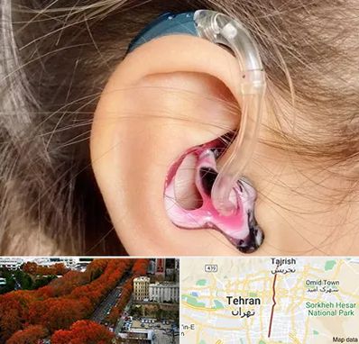 ساخت قالب سمعک در ولیعصر 