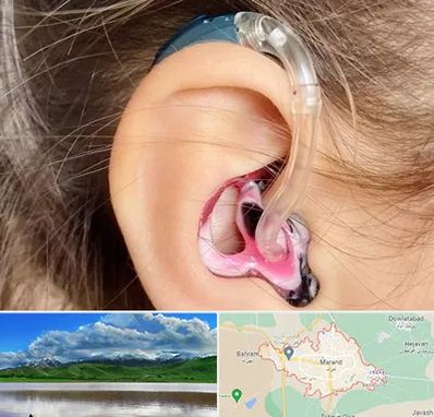 ساخت قالب سمعک در مرند