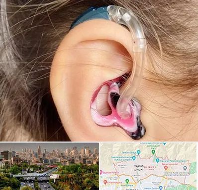 ساخت قالب سمعک در منطقه 1 تهران 