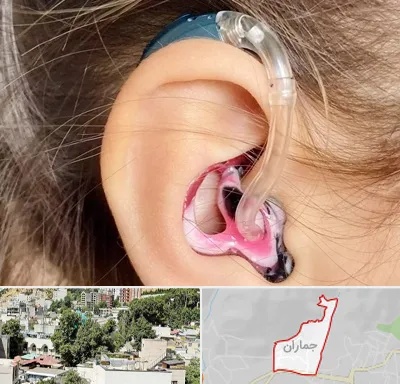 ساخت قالب سمعک در جماران