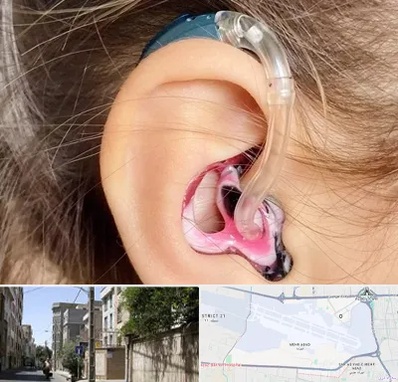 ساخت قالب سمعک در مهرآباد