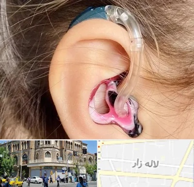 ساخت قالب سمعک در لاله زار