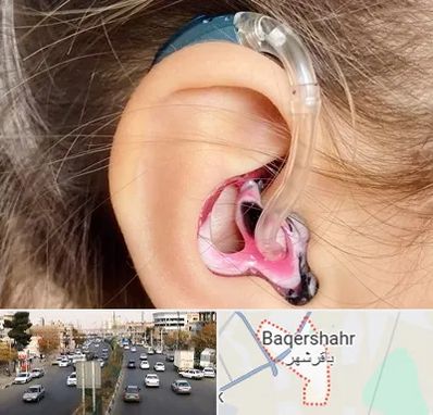 ساخت قالب سمعک در باقرشهر