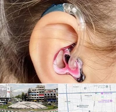 ساخت قالب سمعک در مرکز تهران