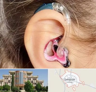 ساخت قالب سمعک در دهدشت