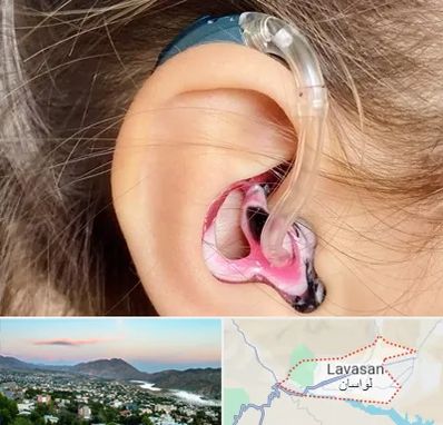 ساخت قالب سمعک در لواسان