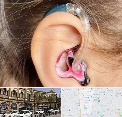 ساخت قالب سمعک در منطقه 11 تهران 