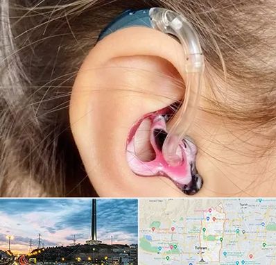 ساخت قالب سمعک در منطقه 2 تهران 