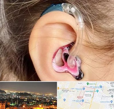 ساخت قالب سمعک در مارلیک کرج 