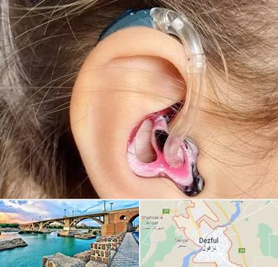 ساخت قالب سمعک در دزفول