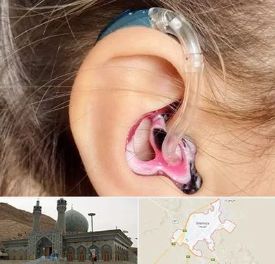 ساخت قالب سمعک در شهرضا