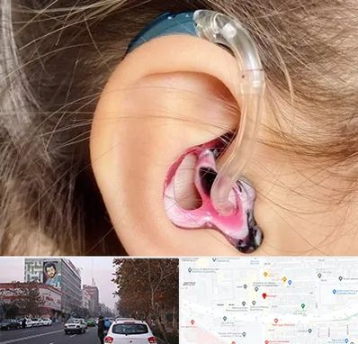 ساخت قالب سمعک در کارگر شمالی 