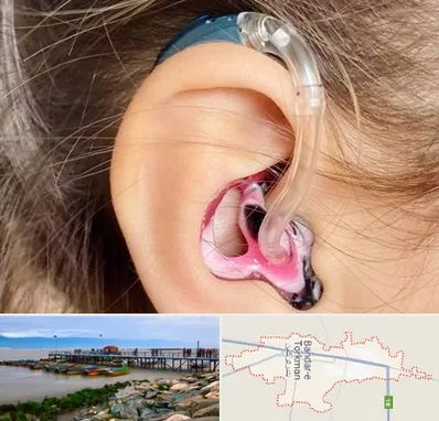 ساخت قالب سمعک در بندر ترکمن