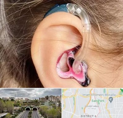 ساخت قالب سمعک در یوسف آباد 