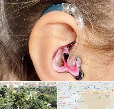 ساخت قالب سمعک در منطقه 13 تهران 